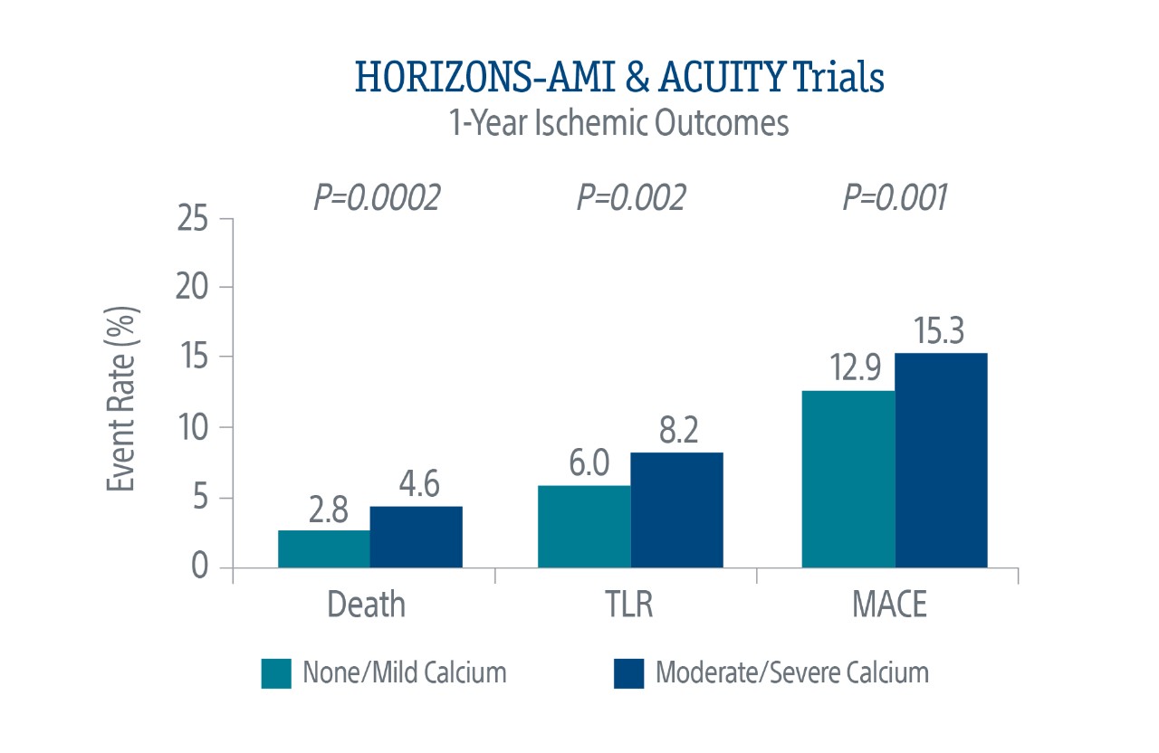 HORIZONS-AMI & ACUITY Trials Chart